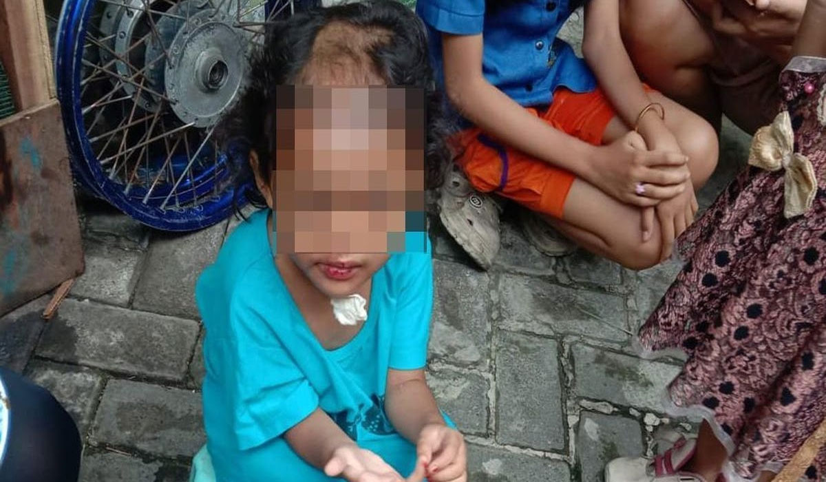 balita-korban-penganiayaan-paman-dan-bibi-kini-dapat-pendampingan-psikologis